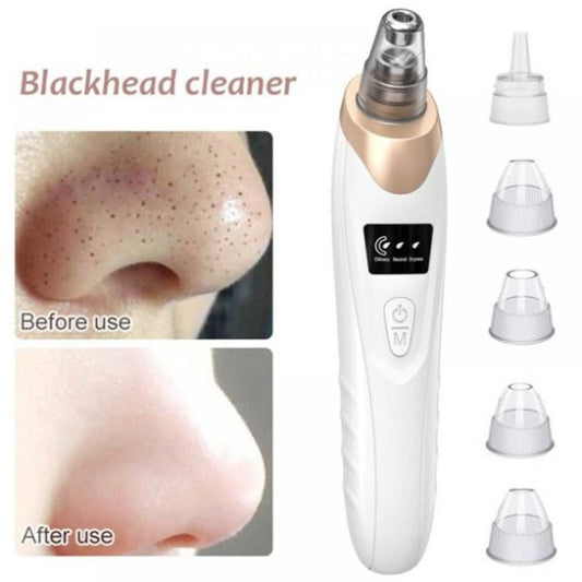 5-in-1Blackhead Suction Remover